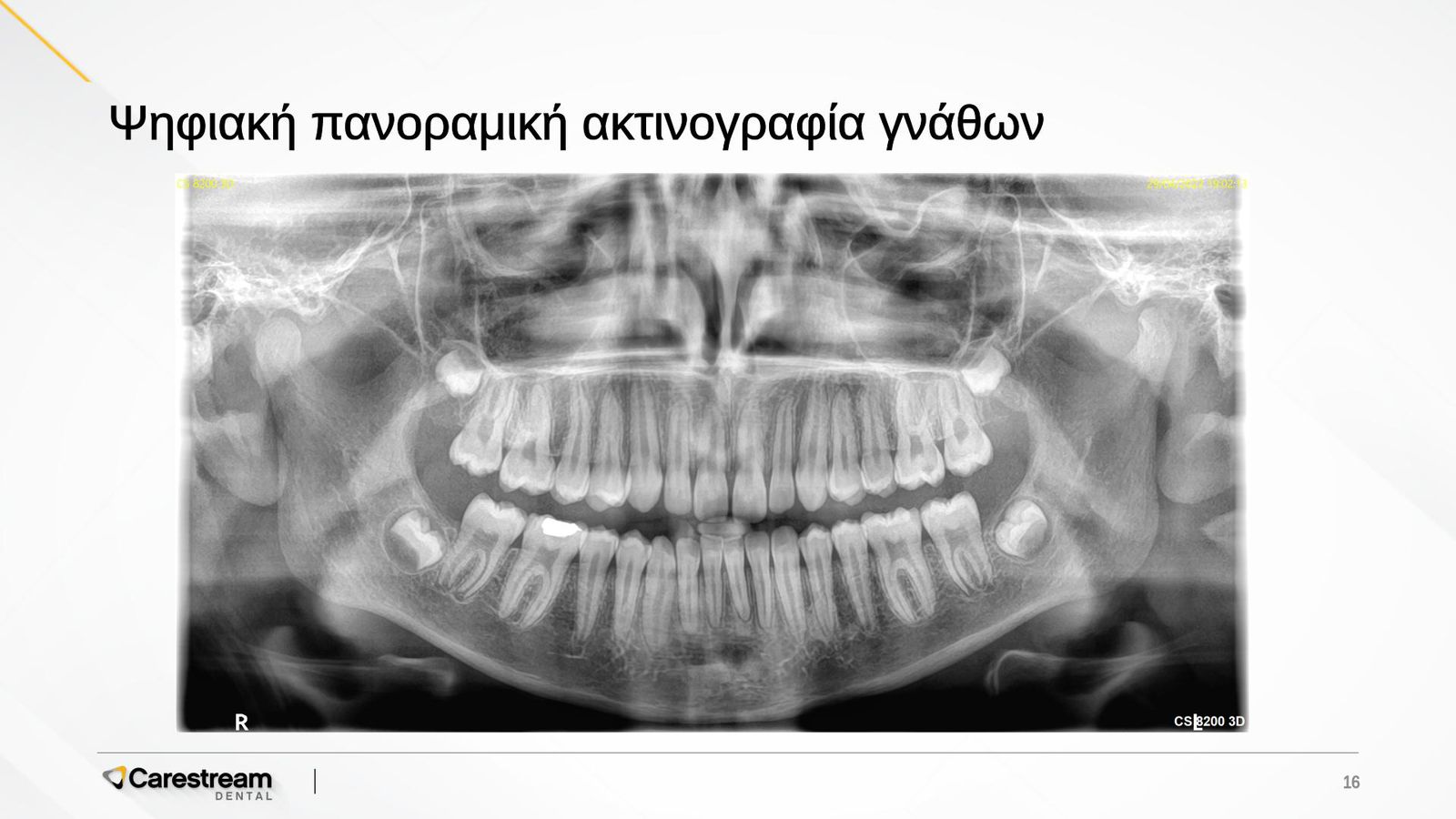 x-ray-01