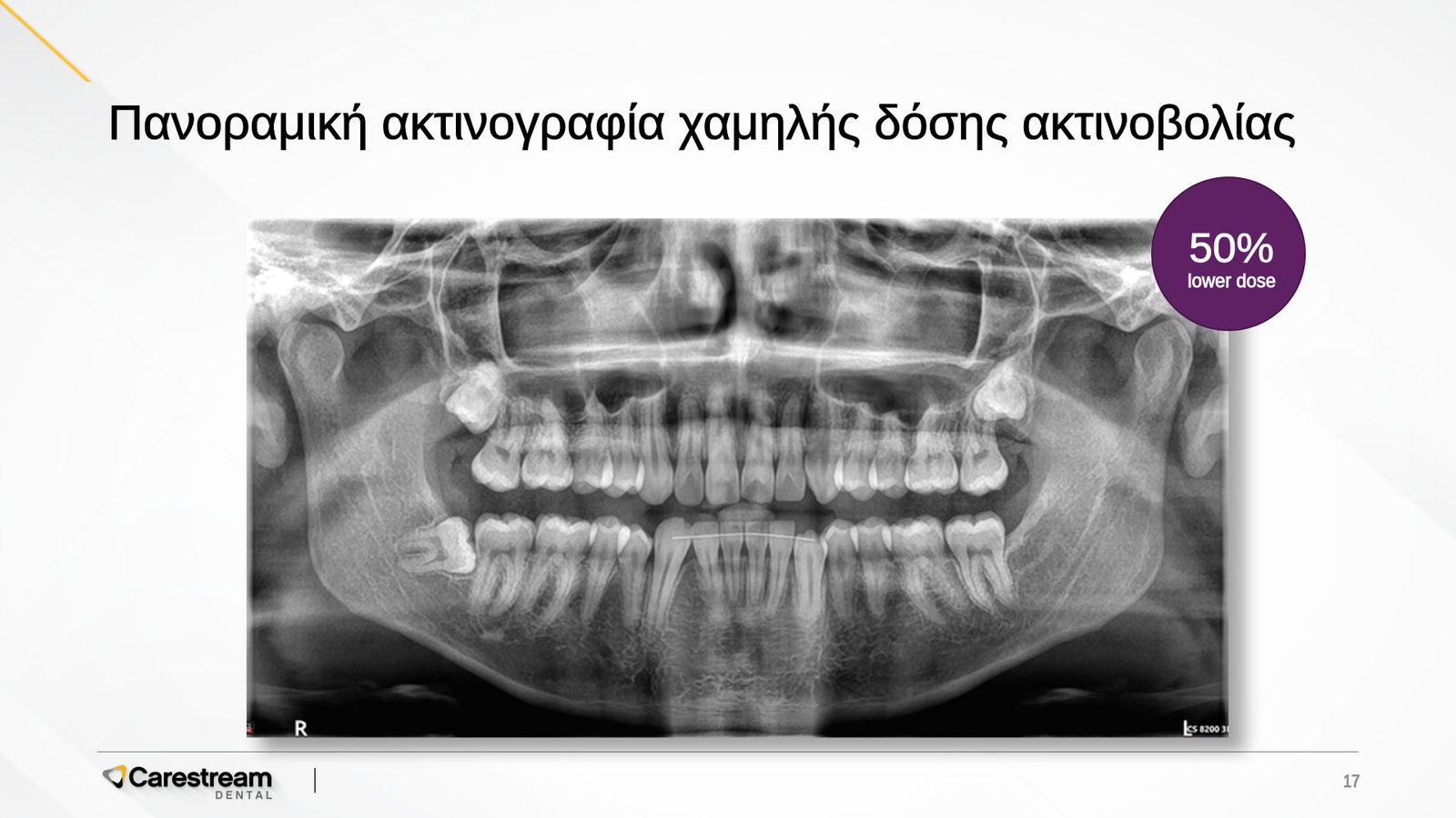 x-ray-04